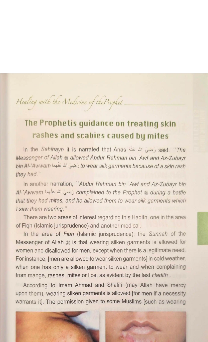 Healing with The Medicine of The Prophet (PBUH)